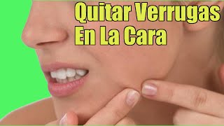 ¿Quieres Eliminar Las Verrugas Planas En La Cara Mira Estos Remedios Naturales [upl. by Donal]