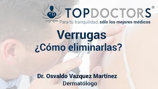 ¿Cómo eliminar las verrugas  Tratamientos [upl. by Zednanref]