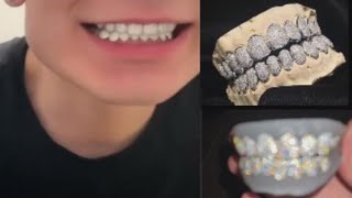 Alibaba Moissanite grillz are they safe [upl. by Anelys477]