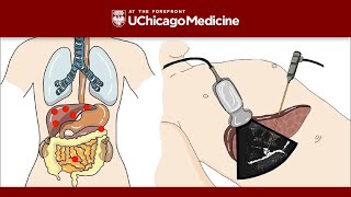 Squamous Cell Carcinoma  Pathology [upl. by Collyer]