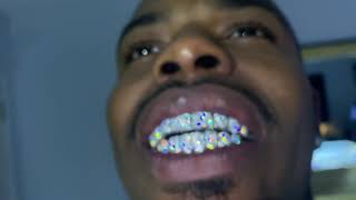 VVS Diamond Grillz In 14KT Yellow Gold amp White Gold [upl. by Iruam]