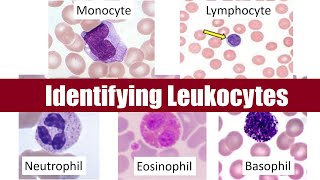 Identifying Leukocytes [upl. by Aleras]