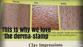 Dermapen Dermaroller DermaStamp HELP HELP [upl. by Gierk]