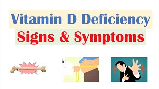 Vitamin D Deficiency Signs amp Symptoms ex Fatigue Diagnosis Treatment [upl. by Follansbee913]