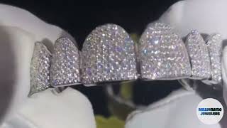 Iced Out Moissanite Grillz [upl. by Gaultiero]