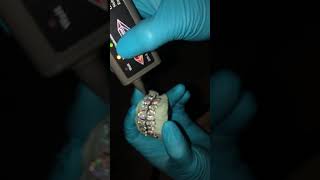 Custom Moissanite Diamond Grillz Versus Diamond Tester [upl. by Oby219]